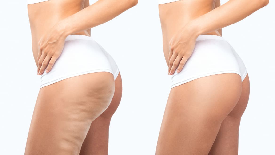 お客様の声、1回の施術でこの変化